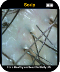 Scalp Type
